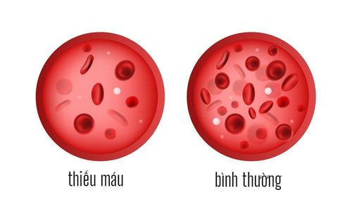 Người bị thiếu máu nhược sắc có cần uống Tardyferon B9 không?