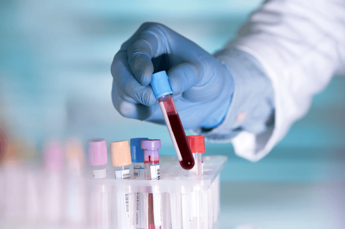 Kết quả xét nghiệm máu và Anti-HBs định lượng có ý nghĩa gì?