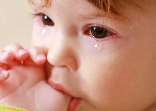 Trẻ bị đỏ mắt và sưng là dấu hiệu của bệnh gì?