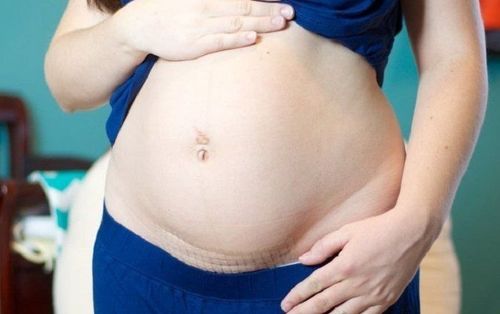 Is the second caesarean section at 37 weeks dangerous?