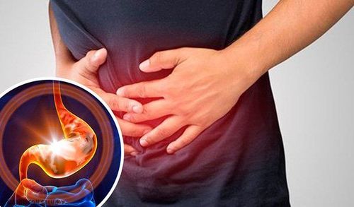 Will stomach ulcers come back after treatment?