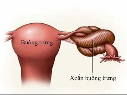 Dấu hiệu đau bụng dưới bên trái có nguy hiểm không?