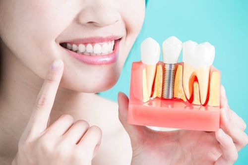 Gắn răng implant có khắc phục được tình trạng má bị hóp không?