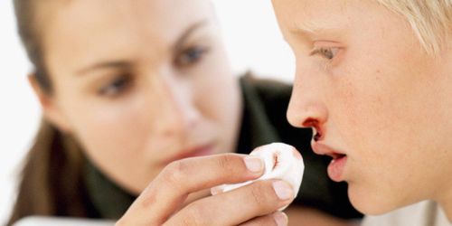 Chảy máu mũi ở trẻ nhỏ: Những điều cần biết