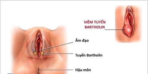 
Các tuyến Bartholin hoạt động sau cơn đau bụng kinh và không thể sờ thấy được.
