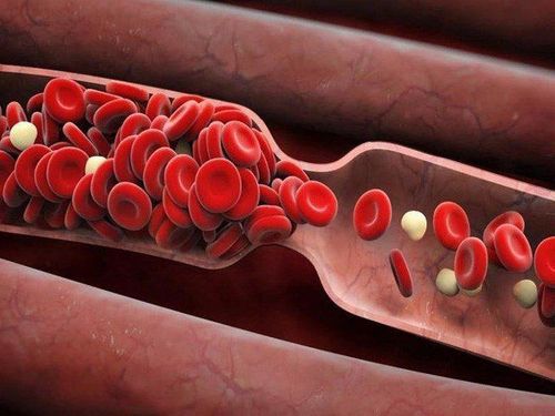 Cách để làm sạch mạch máu của bạn