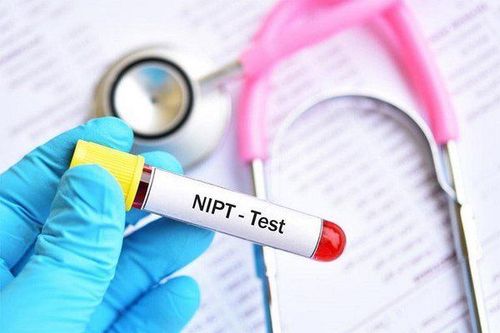 What is the NIPT test used to diagnose?