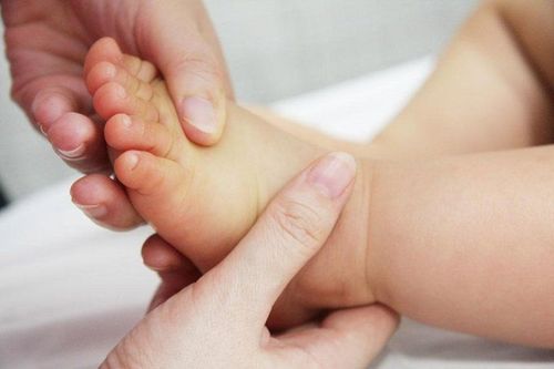 Trẻ 10 tháng tuổi bị vàng da chân tay, ăn ngủ bình thường không sốt quấy có ảnh hưởng gì không?