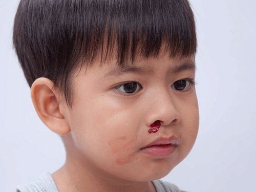 Trẻ bị chảy máu cam thường xuyên có nguy hiểm không?
