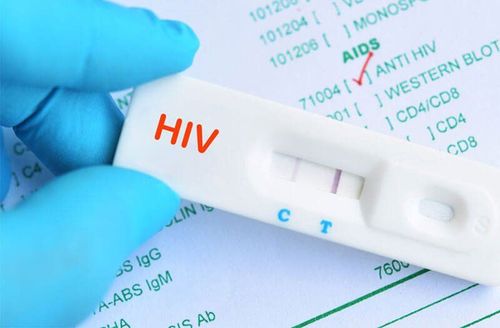 Các biểu hiện gặp phải khi bị nhiễm HIV là gì?