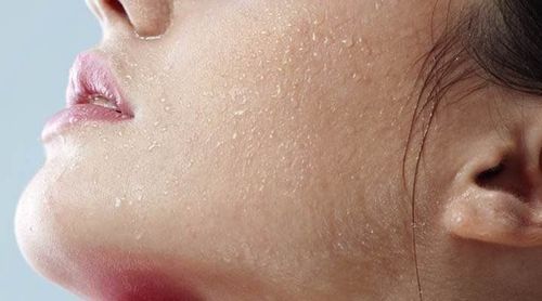 Severe dry skin: Causes, remedies and prevention