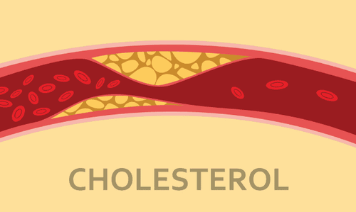 
Ăn mướp đắng có tác dụng giảm cholesterol xấu trong máu
