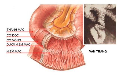 Niêm mạc ruột là gì và vai trò với sức khỏe?