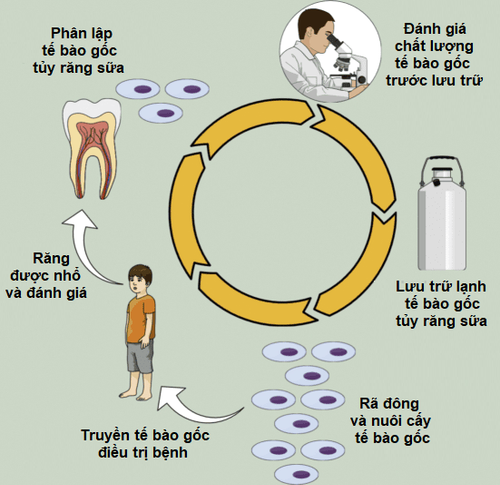 Learn about the process of storing milk tooth pulp stem cells