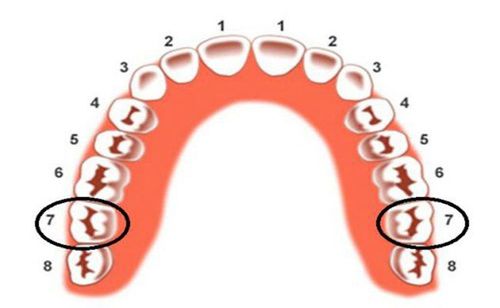 
Răng số 7 là răng vĩnh viễn có kích thước lớn và cấu tạo phức tạp
