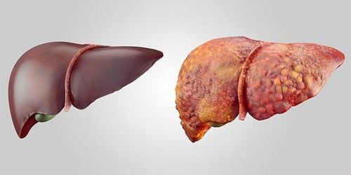 How to recover and restart your liver?