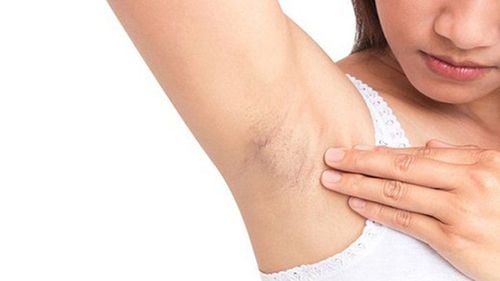 Can pregnant women pluck armpit hair?