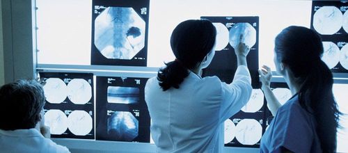 4 reasons why AI can't replace radiologists