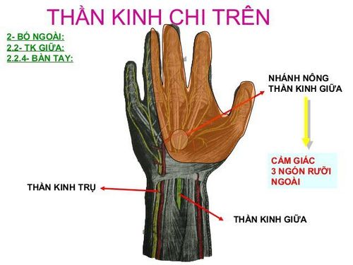 Gây mê phẫu thuật và tổn thương thần kinh chi trên