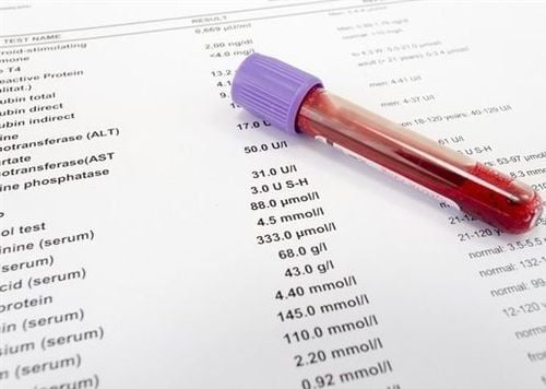 Chỉ số xét nghiệm máu như thế nào là bình thường?