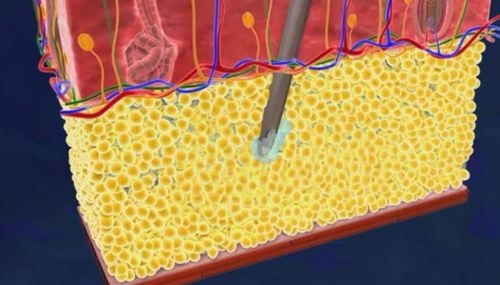 
Mô mỡ dưới da chủ yếu bao gồm các tế bào mỡ và một phần mạch đệm
