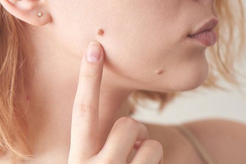 Does mole removal regrow?