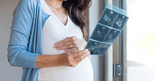 Dị tật thai nhi có nên giữ không?