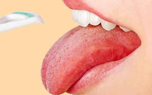 Tongue burning pain, prolonged dry mouth: Don't ignore it