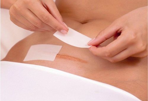 Nhức vết mổ sau sinh có sao không?