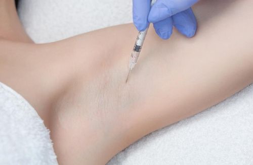 Using Botox to treat hyperhidrosis: What you need to know