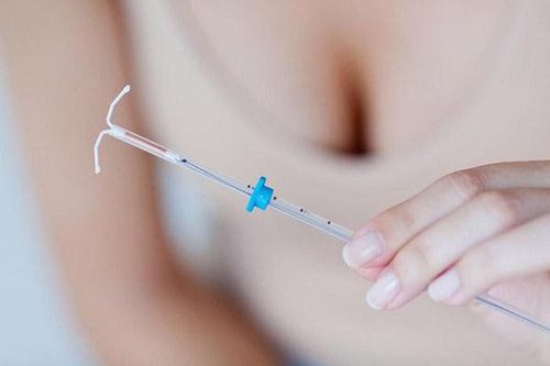 Can I have sex before the IUD is inserted?