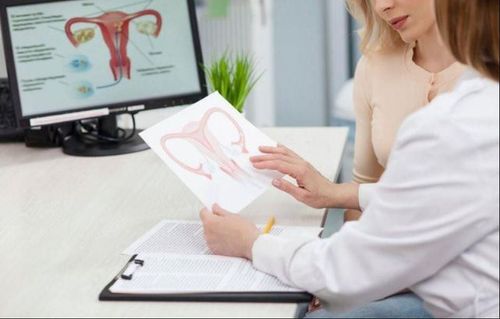 Points to note when treating ovarian cysts