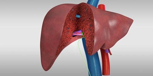 Phẫu thuật nội soi cắt gan phải: Một kỹ thuật phức tạp