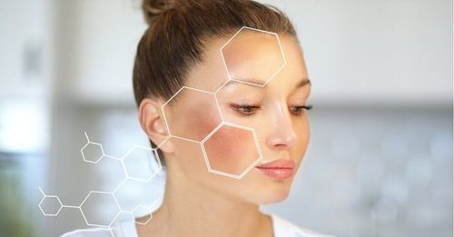 Notes when treating melasma