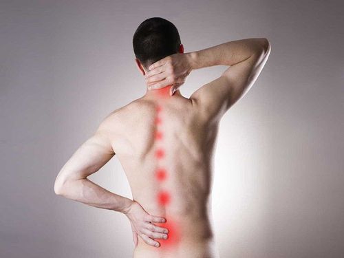 Fibromyalgia symptoms