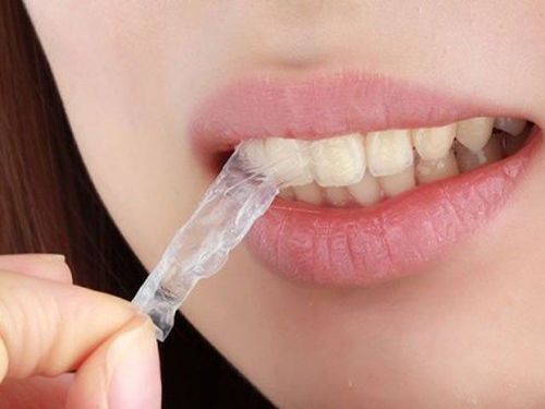 Teeth whitening strips and things to know