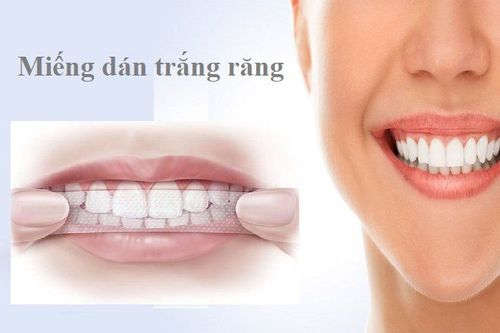 
Miếng dán trắng răng có hiệu quả không là thắc mắc của nhiều người
