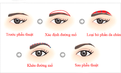 Hanging eyebrows and things to know