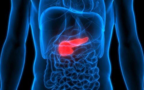 Causes of severe acute pancreatitis