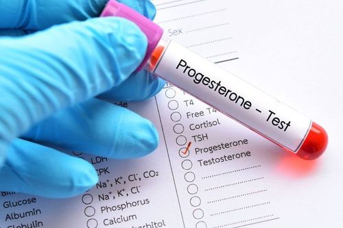 What does the Progesterone test mean?