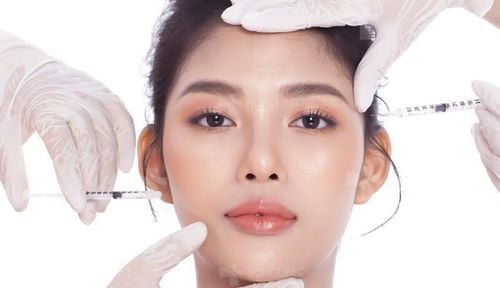 Dysport là gì? Đâu là sự khác biệt giữa Botox và Dysport