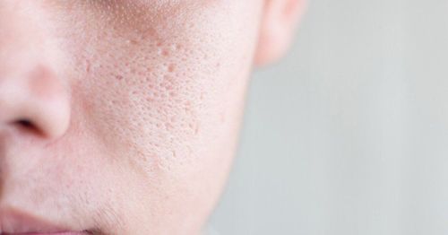 How to tighten pores in men simple but effective