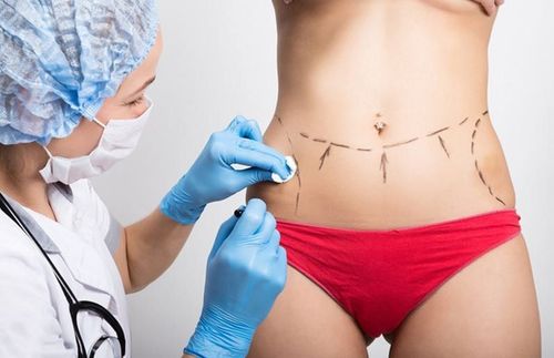 Is liposuction painful?