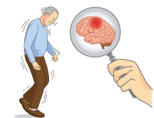 What is the cause of cold in patients with cerebral infarction?