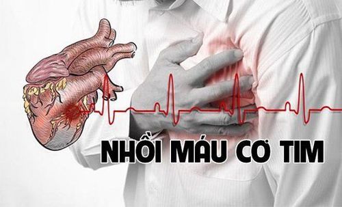 
Tắc mạch sau đặt stent là một biến chứng nghiêm trọng với tỷ lệ nhồi máu cơ tim cao
