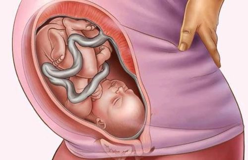 At 30 weeks pregnant, is the umbilical cord wrapped around 1 round?