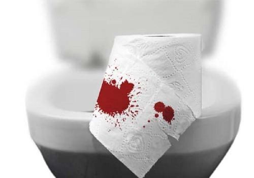 Frequent bowel movements with fresh blood is a sign of what disease?