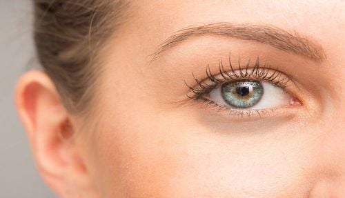 Why do you still have dark circles under your eyes despite adequate sleep?