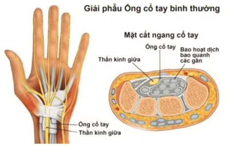 
Giải phẫu ống cổ tay và dây thần kinh giữa
