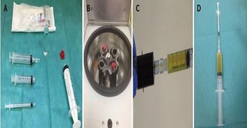Submucosal injection of platelet-rich plasma in endoscopic resection of large pedicleless lesions